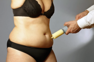 Liposuction zararları